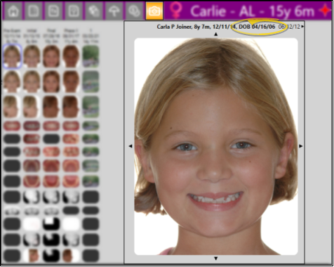 Image of this feature